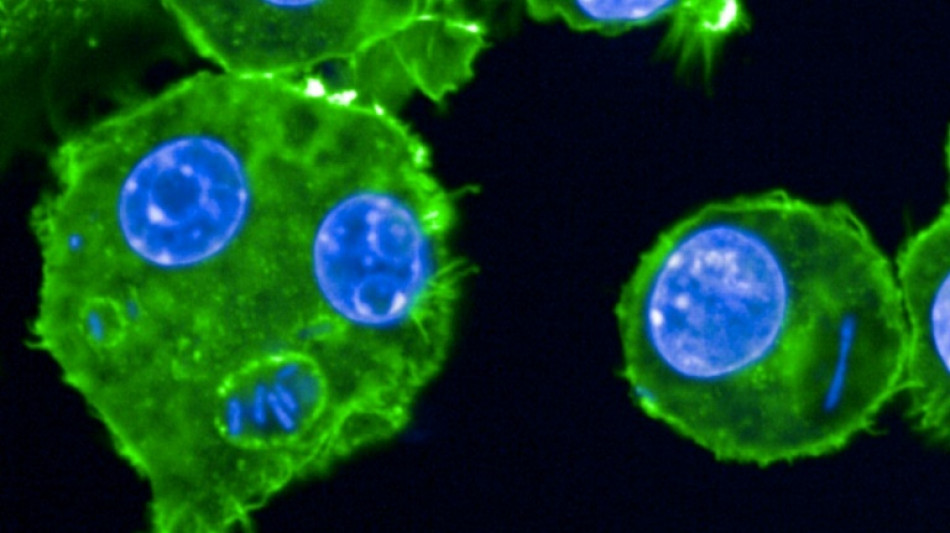 Peste, lèpre... Des chercheurs scrutent les microbes du passé