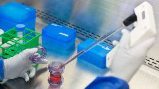 Italiani scoprono un nuovo biomarcatore del cancro gastrico