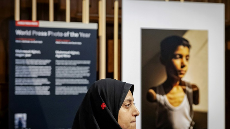 El retrato de un niño palestino amputado gana el World Press Photo