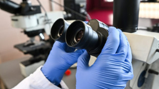 Evolution : le cloaque des poissons a donné l'idée à nos doigts de pousser