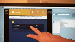 La IA bien utilizada podr&iacute;a mejorar tratamientos para la salud 