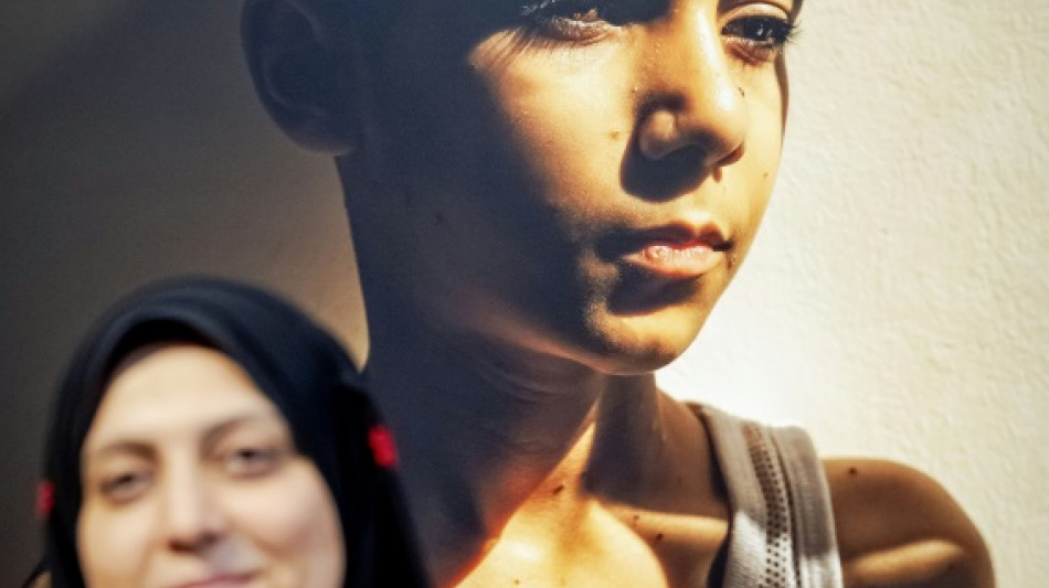 Le portrait d'un enfant palestinien amputé remporte le World Press Photo