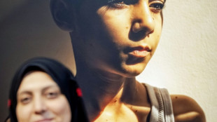 Le portrait d'un enfant palestinien amputé remporte le World Press Photo