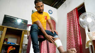 Dup&eacute;s, des Sri-Lankais combattent en Ukraine et n'en reviennent pas