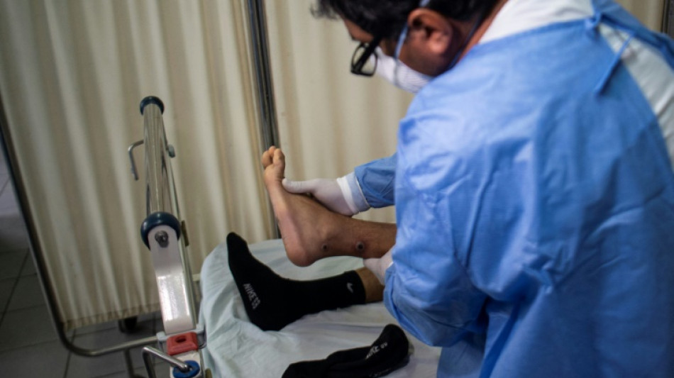 La OMS convoca una reuni&oacute;n del comit&eacute; de emergencia debido a la viruela del mono