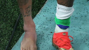 Neymars Kn&ouml;chel verstaucht - weitere Untersuchungen folgen