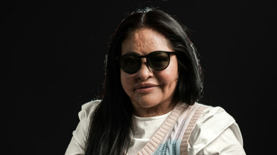 Ayudar para sanar: las mexicanas v&iacute;ctimas de la "violencia &aacute;cida"
