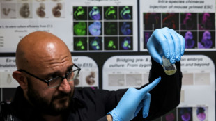 Unos cient&iacute;ficos crean estructuras similares al embri&oacute;n humano sin esperma ni &oacute;vulos