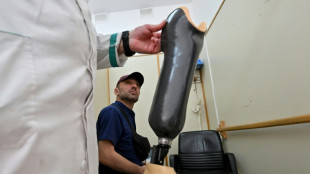 Amput&eacute; &agrave; Marioupol, "Scorpion" n'attend que sa proth&egrave;se pour retourner au front