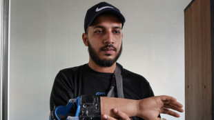 Au Bangladesh, des mains artificielles pour les mutil&eacute;s de la "r&eacute;volution"