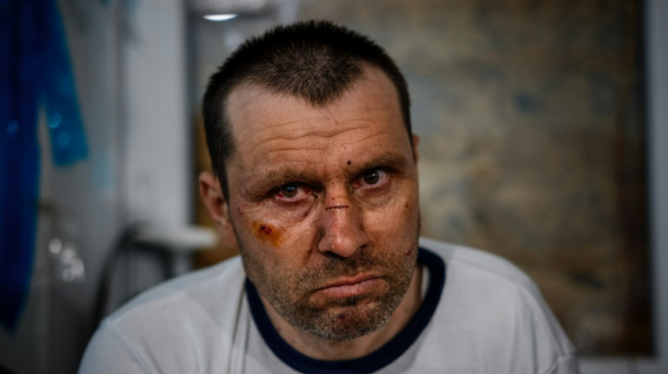 Ukraine: des soldats bless&eacute;s soign&eacute;s la nuit pr&egrave;s de Bakhmout