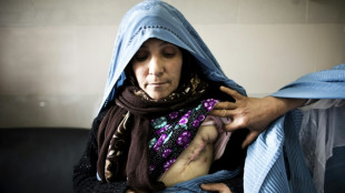 La OMS anuncia que el 80% de las operaciones en Afganist&aacute;n est&aacute;n en riesgo de cierre por falta de fondos