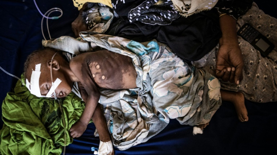 La sequ&iacute;a agrava la desnutrici&oacute;n infantil y llena los hospitales de Somalia