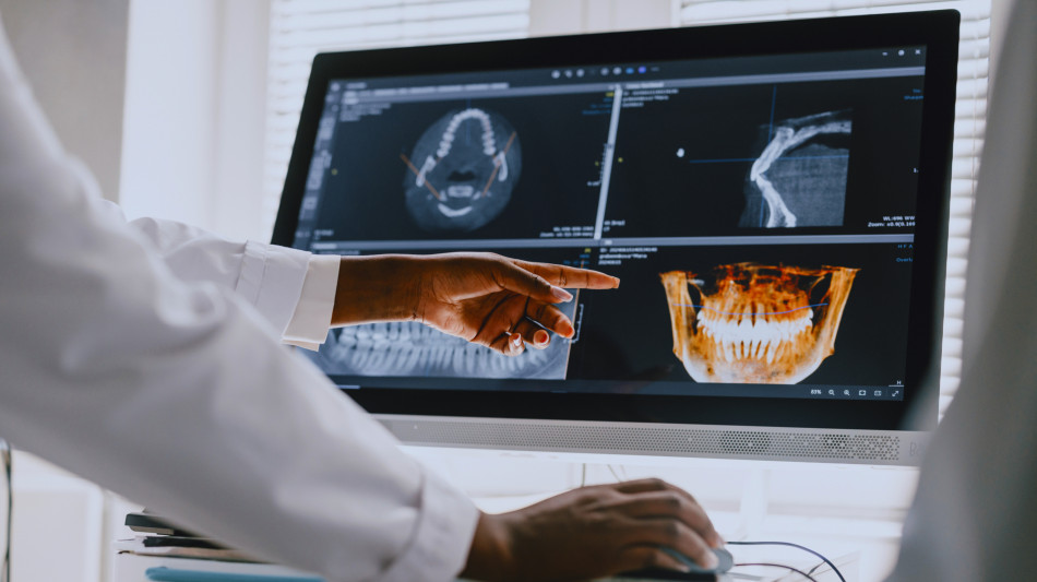 Staminali a gel rigenerano ossa e gengive, impianti pi&ugrave; rapidi