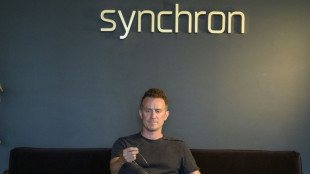 Etats-Unis: un patient utilise Alexa d'Amazon avec son implant c&eacute;r&eacute;bral, une premi&egrave;re