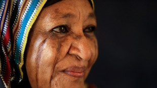 Marqu&eacute;s &agrave; vie: les derniers scarifi&eacute;s du Soudan