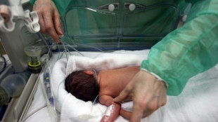 Face &agrave; la hausse de la pr&eacute;maturit&eacute;, la France veut am&eacute;liorer la prise en charge