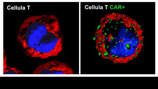 Linfomi, il 70-75% dei pazienti pu&ograve; guarire o vivere a lungo
