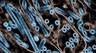 Grippe aviaire: de r&eacute;centes contaminations suscitent l'inqui&eacute;tude aux Etats-Unis