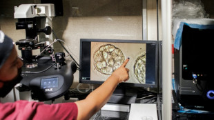 L'infertilit&eacute; touche une personne sur six selon l'OMS