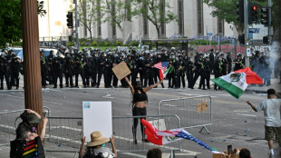 AFP photographer shot in face with rubber bullet at LA protest