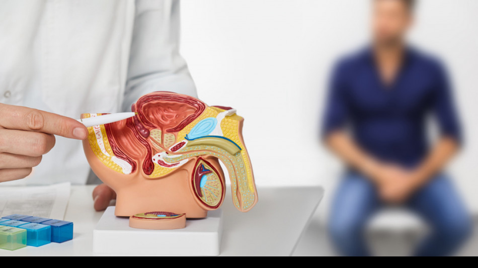 Oltre 485mila vivono con tumore prostata, decessi in crescita